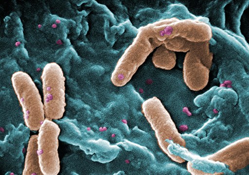 Pseudomona Bacteria