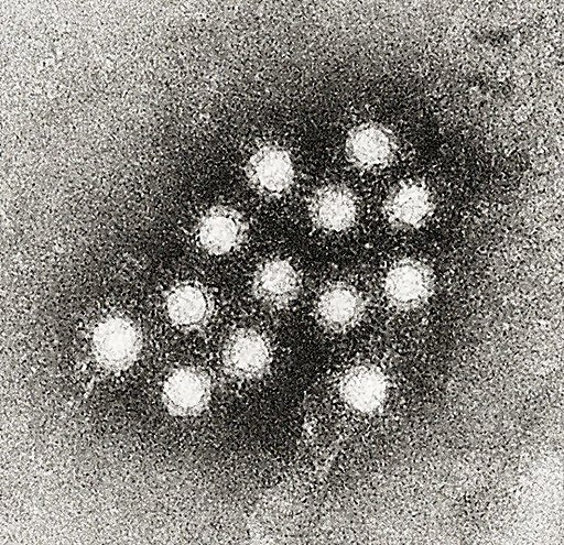 Hepatitis A virus